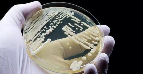 Deadly fungal infection 'Candida auris' with death rate of 60% spreading rapidly
