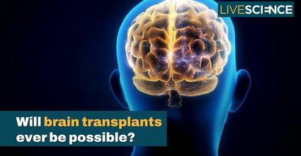 Will Brain Transplants Ever Be Possible? | LiveScience